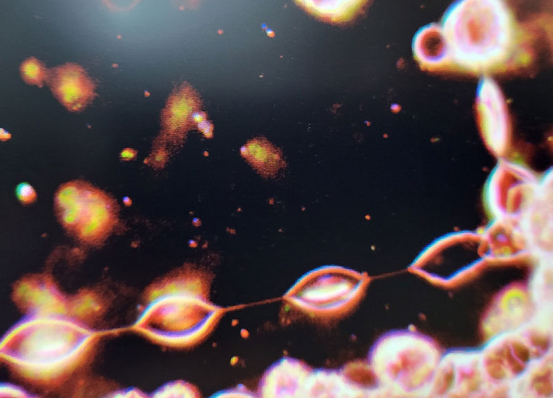 Trichomonadenkette beim aussaugen der Erythrozyten